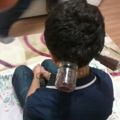  Saç kesmeden hacamat